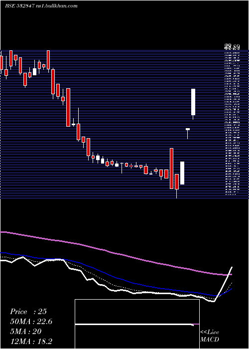  Daily chart HiltonMet